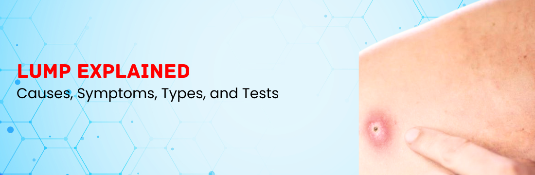 Lump Explained: Causes, Symptoms, Types, and Tests